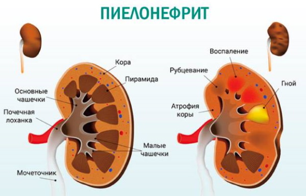 Канефрон схема приема