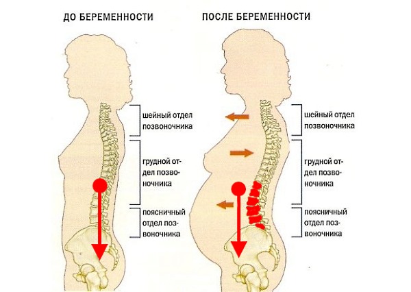 Болит поясница сильно, ноет. Причины и лечение у женщин