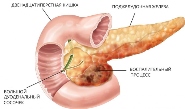 Болит поясница сильно, ноет. Причины и лечение у женщин