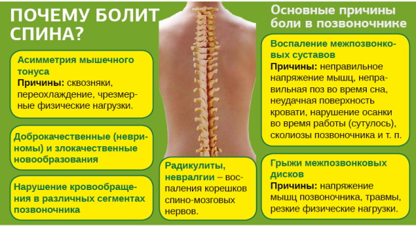 Болит поясница сильно, ноет. Причины и лечение у женщин