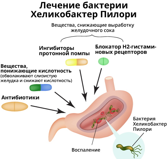 Бактерия хеликобактер пилори в желудке. Как лечить медикаментозно