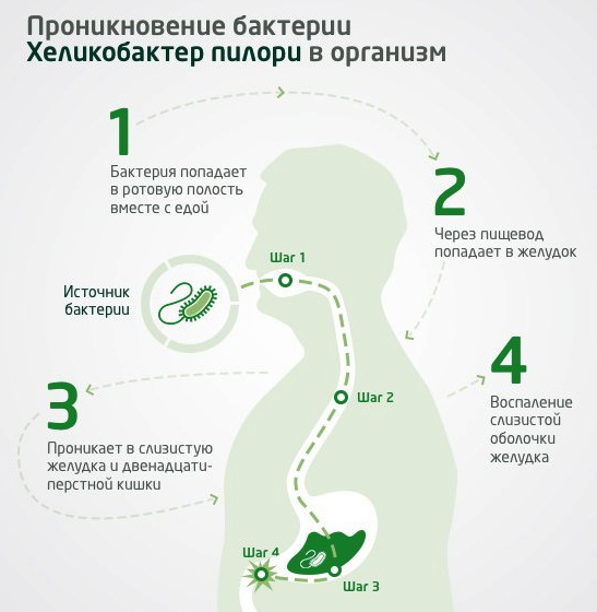 Бактерия хеликобактер пилори в желудке. Как лечить медикаментозно