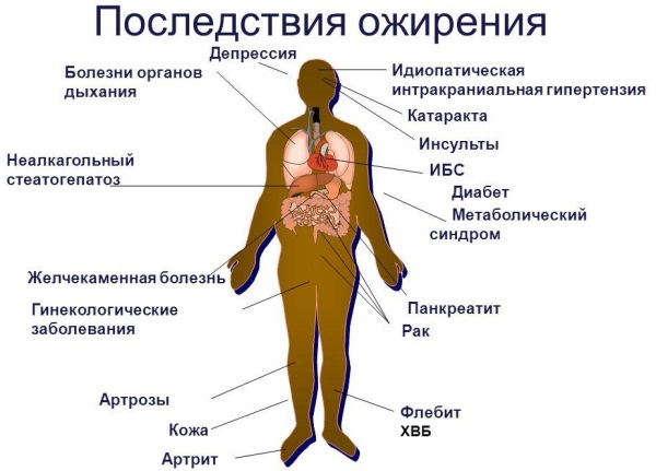 ИМТ (Индекс массы тела). Как рассчитать, формула, оценка результатов