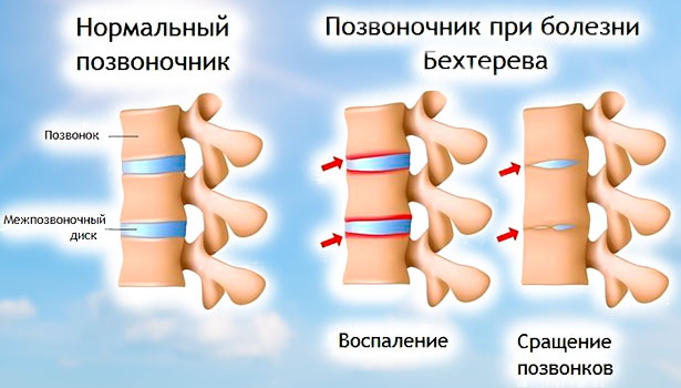 Мануальная терапия позвоночника. Цена сеанса, отзывы