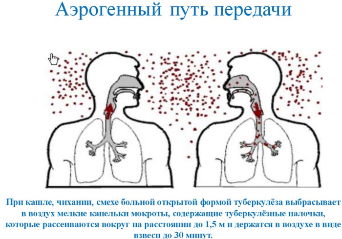 Механизмы (пути) передачи инфекции, инфекционных заболеваний. Что это, примеры