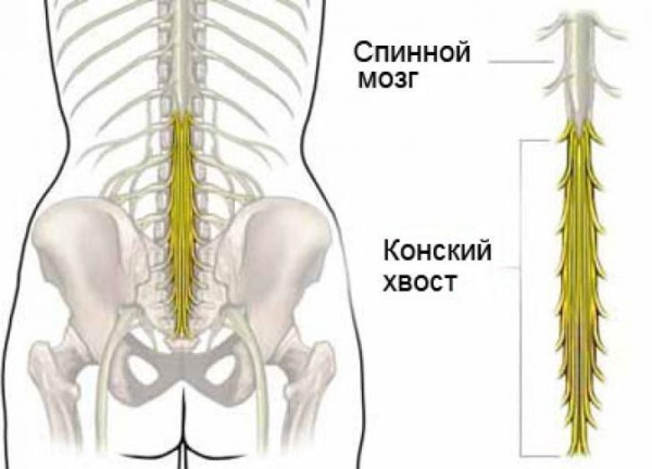 Метастазы в позвоночнике. Лечение народными средствами, химиотерапией