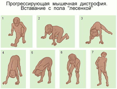 Наружные косые мышцы живота. Функции, анатомия, болит, растяжение, спазм