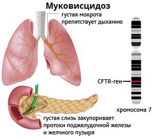 Неонатальный скрининг новорожденных. Что это такое, сроки