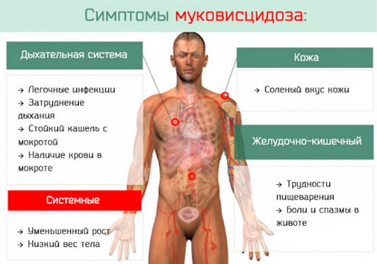 Неонатальный скрининг новорожденных. Что это такое, сроки