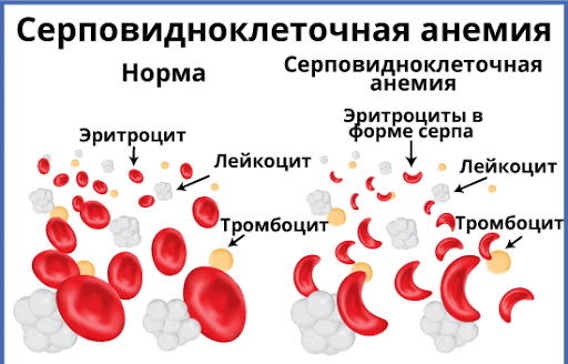 Неонатальный скрининг новорожденных. Что это такое, сроки