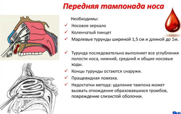 Кровотечение на фоне приема жанина