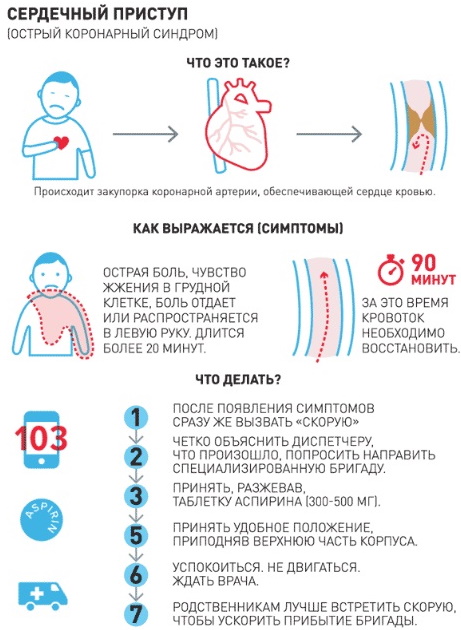 Боль при стенокардии фото