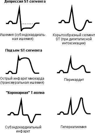 Оим с подъемом st карта вызова