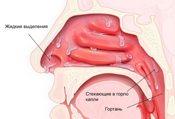 Риноцитограмма у детей. Расшифровка, норма в таблице