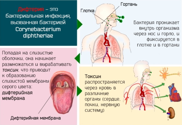 Риноцитограмма у детей. Расшифровка, норма в таблице