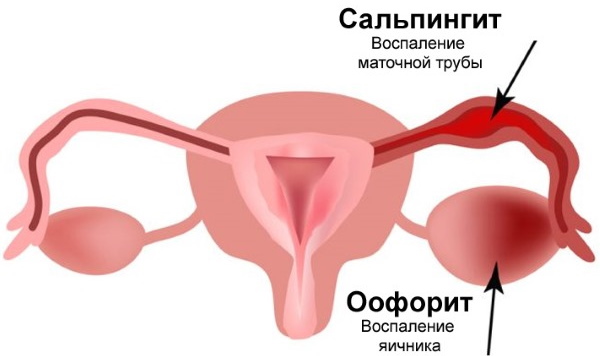 Кандидозный кольпит (вагинит). Лечение у женщин, клинические рекомендации