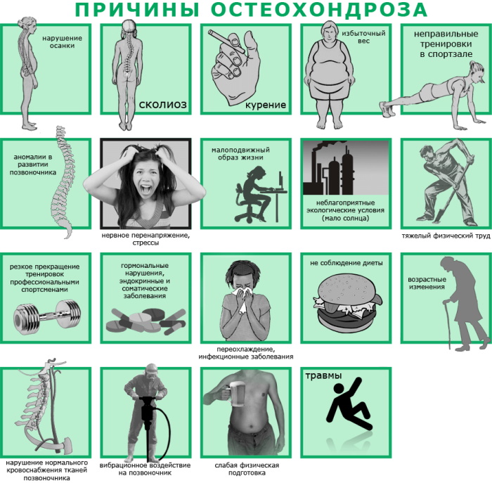 Шейный хондроз. Симптомы и лечение, препараты