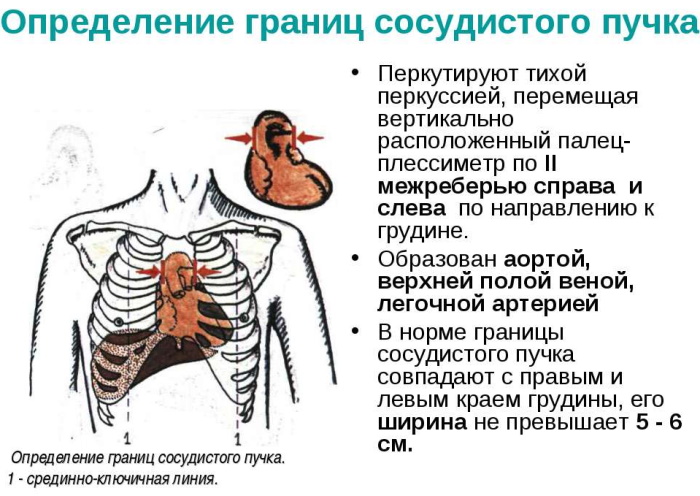 Ширина сосудистого пучка. Норма у детей, как определяется