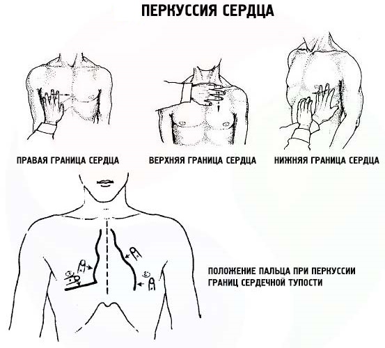 Ширина сосудистого пучка. Норма у детей, как определяется