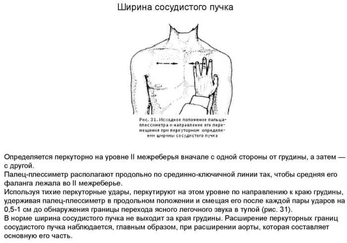 Ширина сосудистого пучка. Норма у детей, как определяется