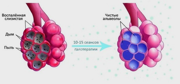 Соляная пещера. Польза для здоровья взрослых, детей