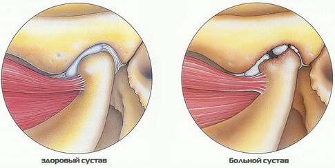 Височно-нижнечелюстной сустав. Анатомия, строение, функции, лечение