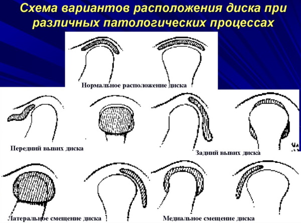 Височно-нижнечелюстной сустав. Анатомия, строение, функции, лечение