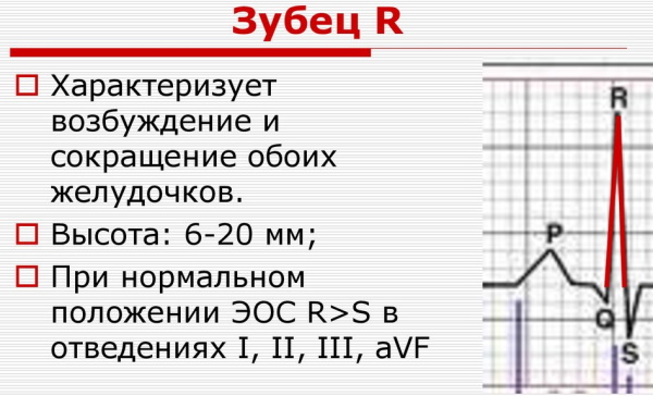 Как прочитать электрокардиограмму сердца самому. Расшифровка ЭКГ