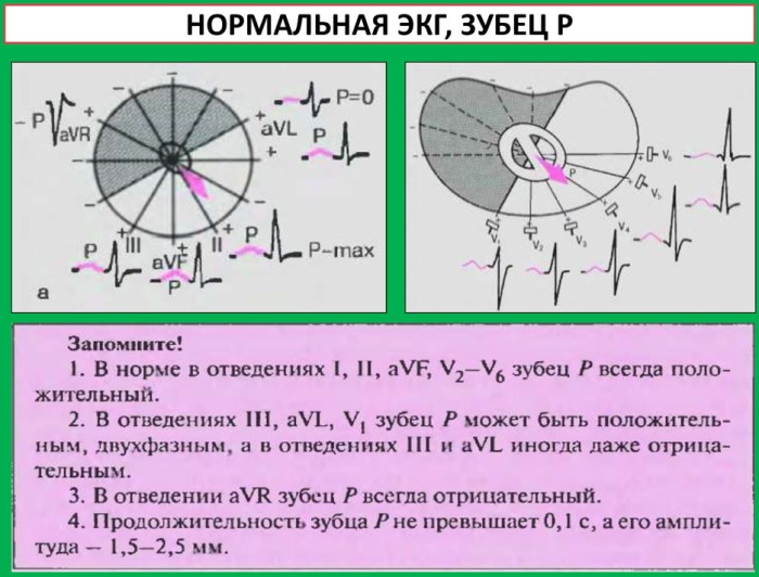 Какую музыкальную форму отражает данная схема r э1 r э2 r э3