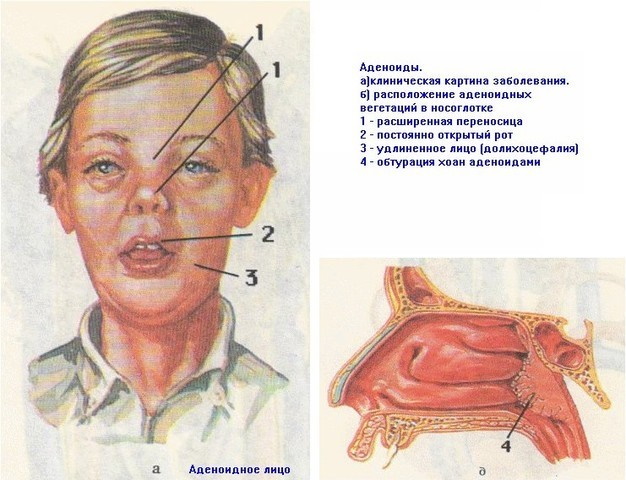 Почему закрывают лицо ребенка на фото