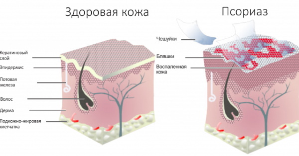 Аутоиммунные заболевания. Список болезней, симптомы и лечение