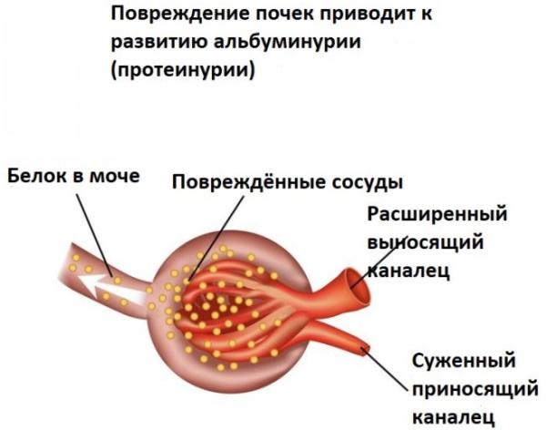 Белок в моче у ребенка. Что это значит, норма, повышен, причины