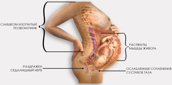 Болит копчик при беременности в 1-2-3 триместре. Причины, что делать