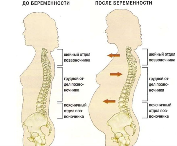 Болит копчик при беременности в 1-2-3 триместре. Причины, что делать