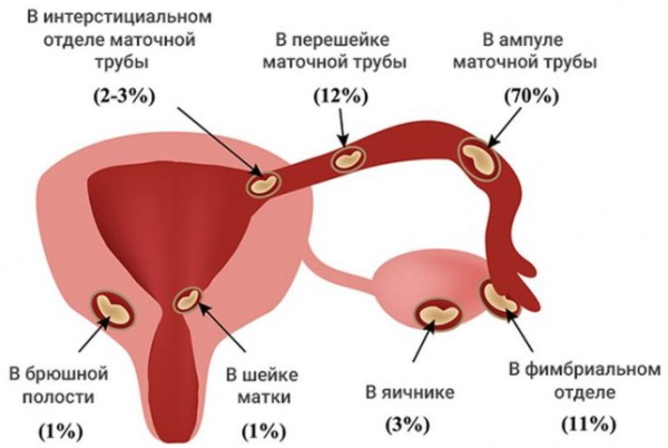 Болит копчик при беременности в 1-2-3 триместре. Причины, что делать