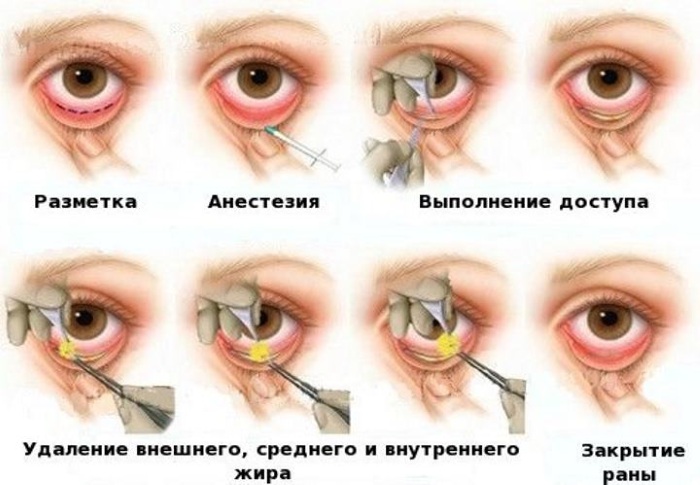 Как по глазам определить болезнь картинки