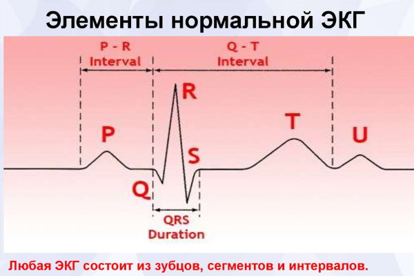 Интервал PQ на ЭКГ. Норма у детей, взрослых, какой процесс отражает, чему соответствует