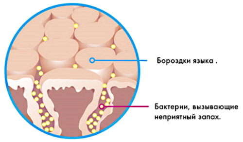 Корень языка. Где находится, схема, какой воспринимает вкус, как болит