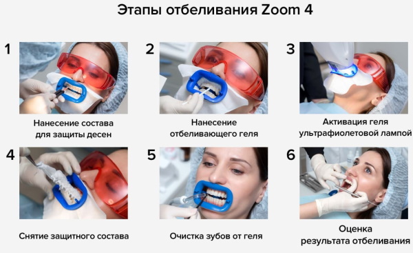 Косметическое отбеливание зубов. Отзывы