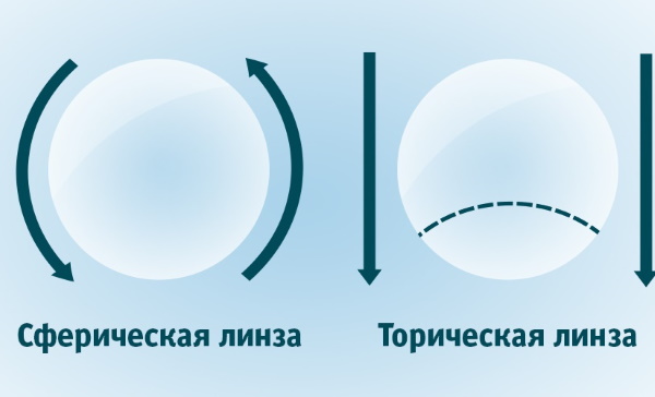 Линзы для глаз. Виды, характеристики, сроки ношения