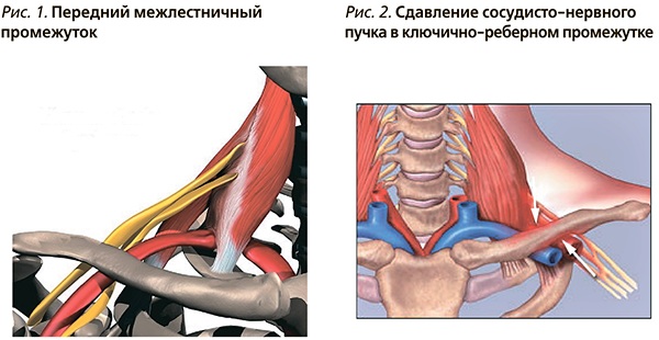 Малая грудная мышца. Анатомия, функции, упражнения, синдром