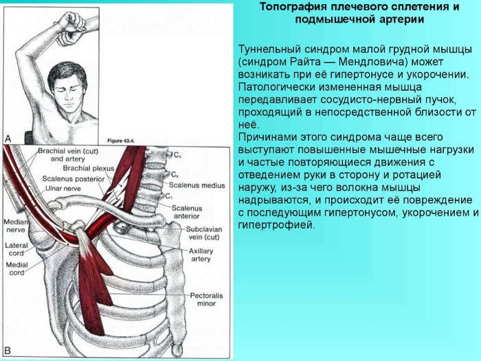 Малая грудная мышца. Анатомия, функции, упражнения, синдром