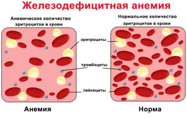 Онемение языка. Причины у женщин при головной боли, давлении, приеме пищи, алкоголя