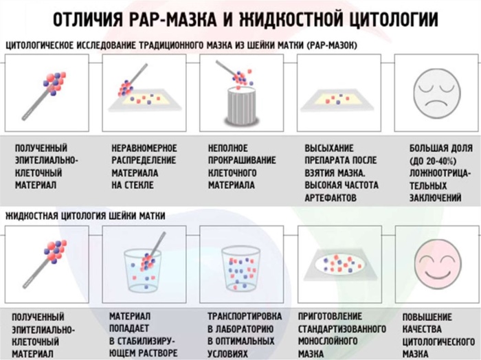 Жидкостная онкоцитология шейки матки. Что это такое, подготовка к процедуре, как делают