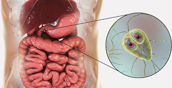 Лямблии у взрослых. Лечение, препараты, народные средства