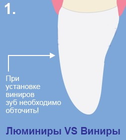 Люминиры на зубы. Цена с установкой, что это такое, минусы, плюсы, отзывы