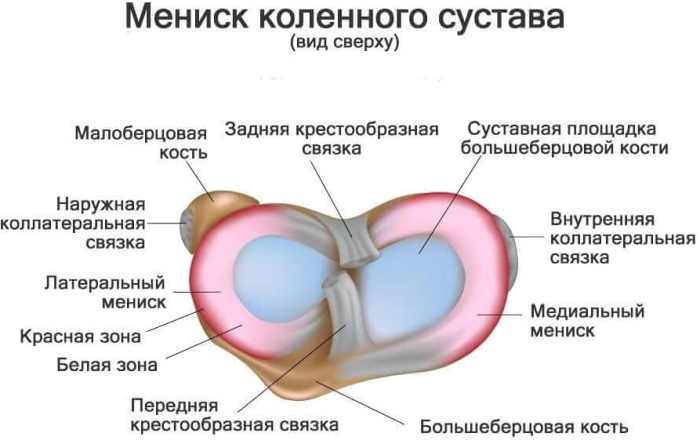 Мениск коленной чашечки. Лечение повреждения сустава, народные средства, мази, таблетки