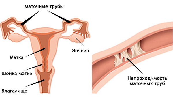 Гинекологическое УЗИ: виды, как называется ультразвуковое исследование внутренних органов