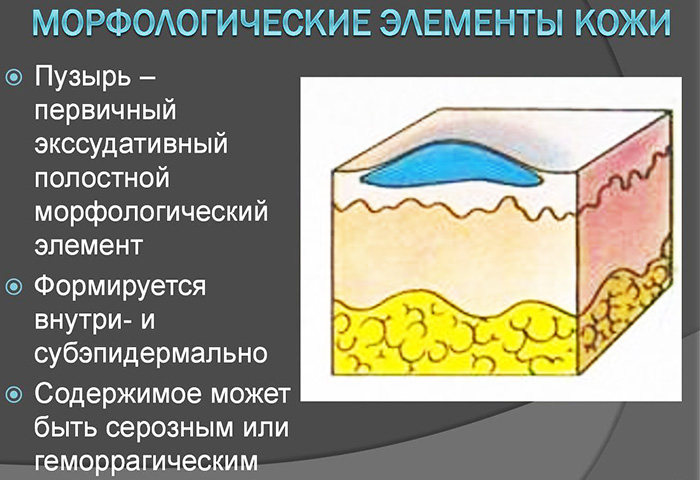 Морфологические элементы кожи первичные и вторичные. Таблица