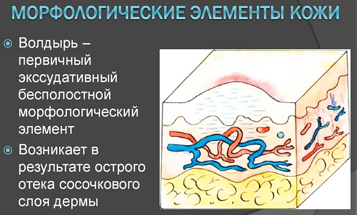 Первичные морфологические элементы презентация